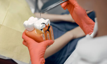 Pain Free Root Canals