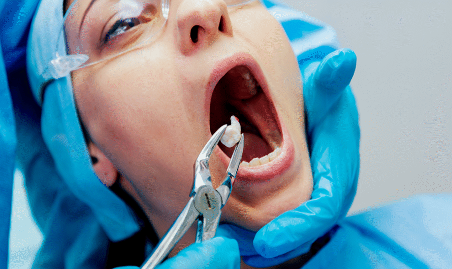 Tooth Extraction: Why Dentists Recommend Tooth Extraction and How It Helps Your Smile.