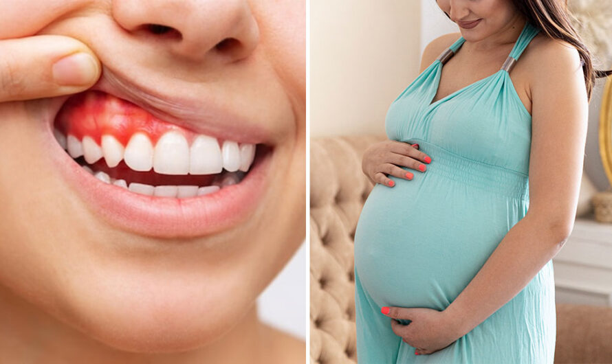 Are Bleeding Gums During Pregnancy Really ‘Normal’ or a Warning Sign You Shouldn’t Ignore?