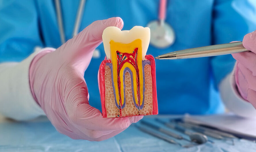 What Is Root Canal Treatment? A Complete Guide from Diagnosis to Recovery