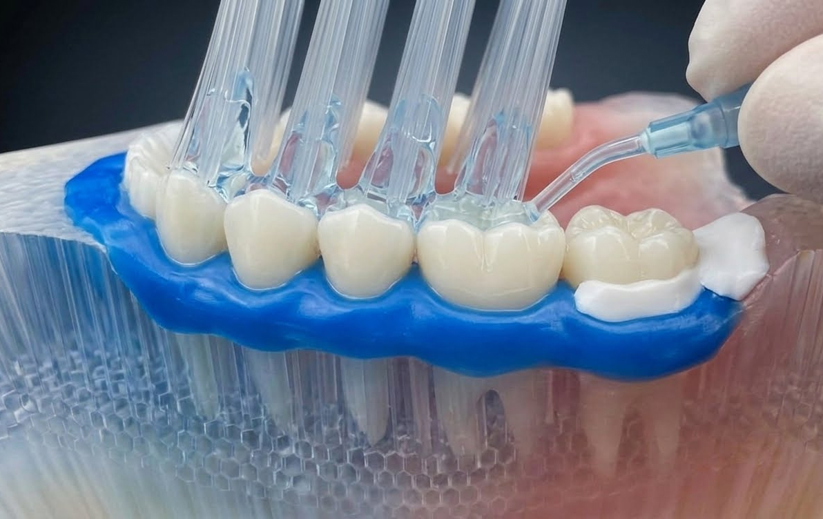 Teeth Whitening Scams: Why Baking Soda and Charcoal Toothpastes Destroy Your Enamel Permanently 4 Professionals Whiten Teeth