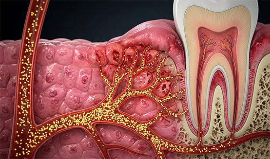 The Deep Connection Between Diabetes and Gum Disease: Why Blood Sugar Control Impacts Your Smile 2 Why Diabetes Weakens Your Gums