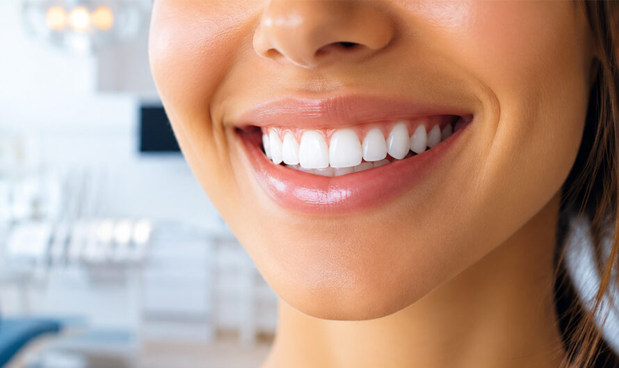 Porcelain Veneers vs. Composite Bonding: A Comprehensive Cost and Longevity Breakdown for a Hollywood Smile