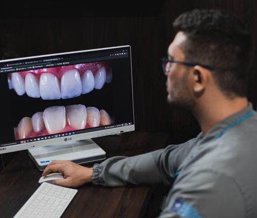 Predictive Digital Smile Design (DSD)