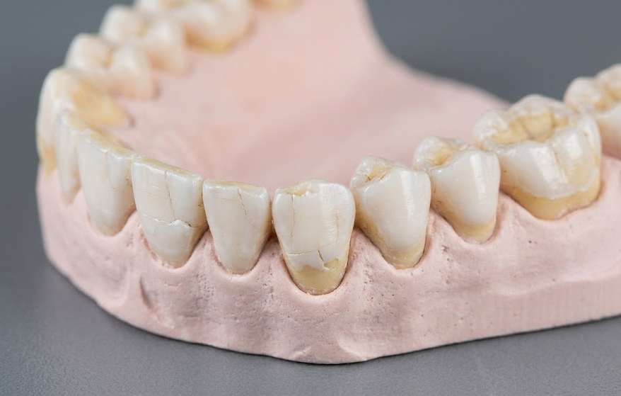 Why Your Enamel Cannot Take the Pressure
