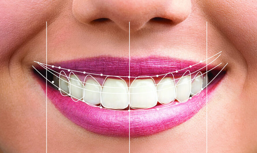 How to Prepare Your Mind, Schedule, and Health Before a Major Full-Mouth Smile Transformation
