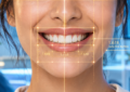 How Digital Smile Design (DSD) Uses the "Golden Proportion" to Map Restorations Perfect for Your Face Shape