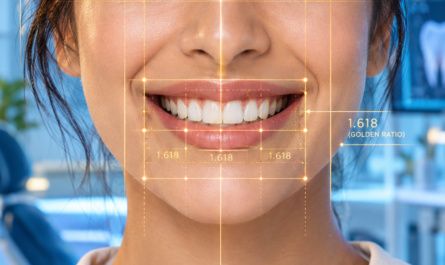 How Digital Smile Design (DSD) Uses the "Golden Proportion" to Map Restorations Perfect for Your Face Shape