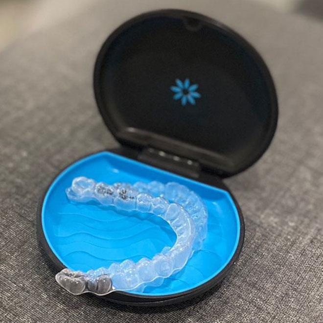 Braces / Invisalign