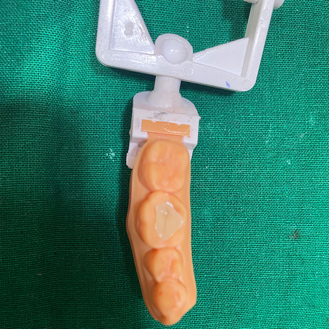 Fillings & Restorative dentistry