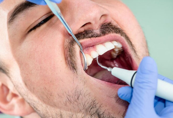 Preventive Treatment